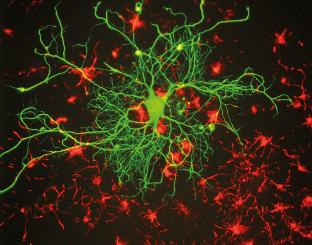 Großes Neuron im Gehirn der Ratte, Foto: EnCor Biotechnology Inc. / GerryShaw (via Wikimedia / CC BY-SA 3.0)